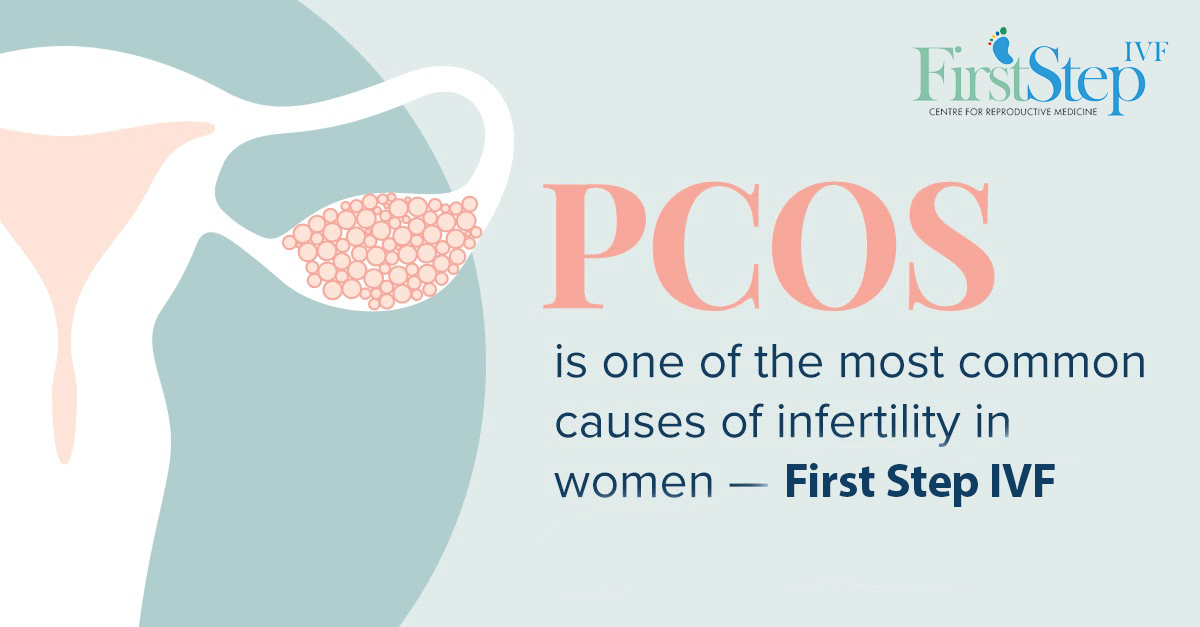 How PCOS One Of The Causes Of Infertility Can Affect The Chance Of 